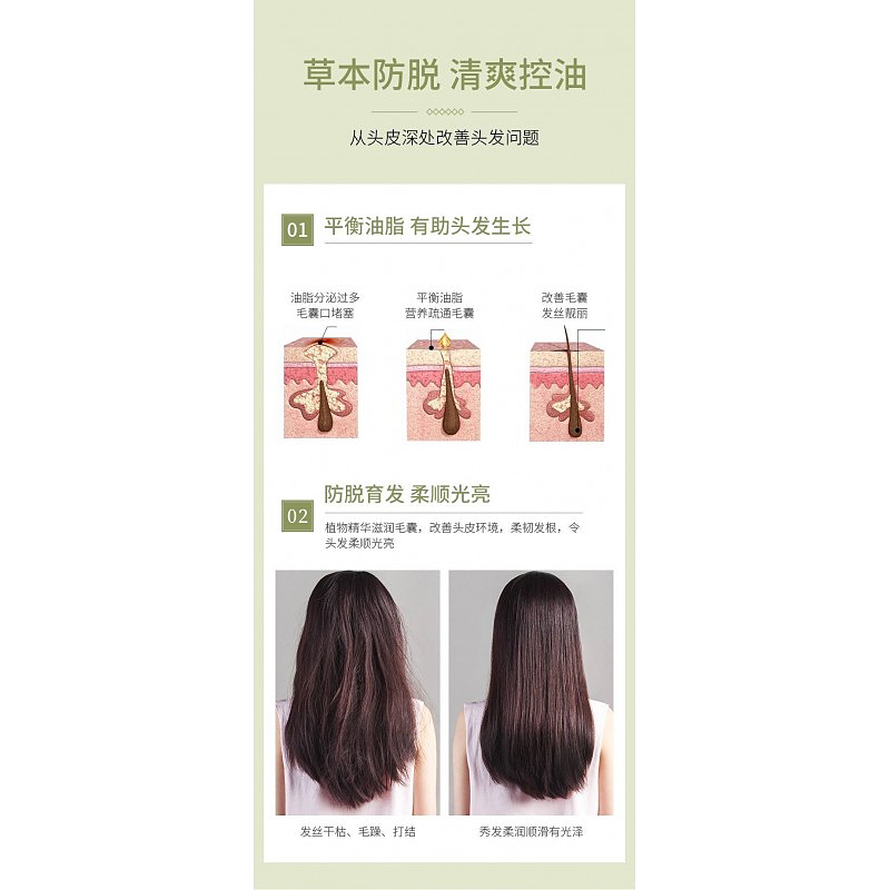 شامپو-ضد-ریزش-مو-اصلی-bioaqua-hair-loss-prevention-shampoo