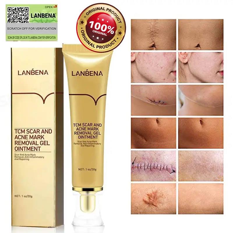 ژل-ترمیم-کننده-جای-جوش-و-اسکار-لانبنا-LANBENA